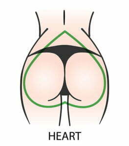 A Shaped Buttocks or Heart Shape