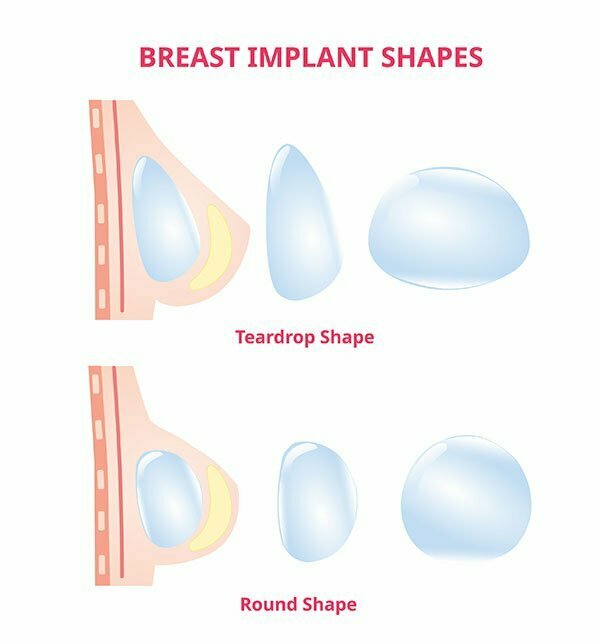 breast implants shapes
