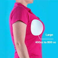 large breast implants