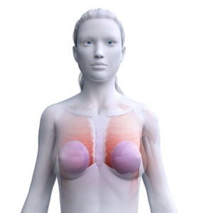 Implant-based breast reconstruction in miami